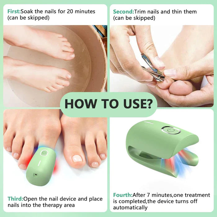 KTS® Nail Fungus Laser Therapy Device